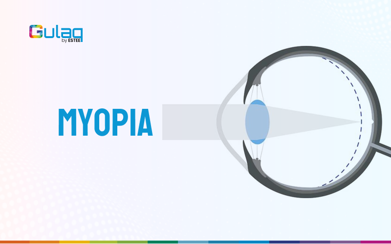 Myopia
